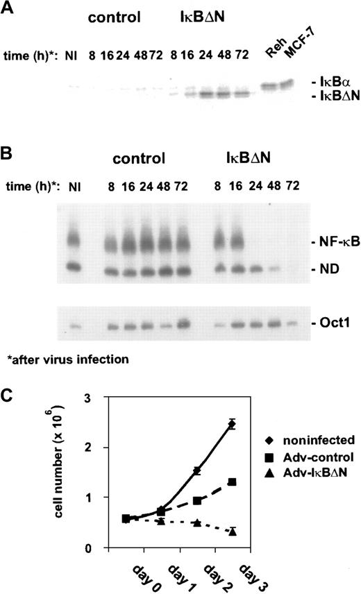 Fig. 1. Adenovirus-mediated IκBΔN expression abrogates NF-κB activity and affects growth of L428 cells. / (A) Expression of IκBΔN in L428 cells. L428 cells were infected with an adenovirus expressing IκBΔN or with a control adenovirus containing an empty expression cassette (Ad5-IκBΔN and Ad5-control; MOI 300). Whole-cell extracts of infected and control cells (MCF-7, Reh) were prepared at the indicated time points and analyzed by Western blotting with anti-IκBα antibody. Note that L428 cells are defective in wild-type IκBα expression. (B) NF-κB binding activity. Whole-cell extracts of L428 cells infected with Ad5-control and Ad5-IκBΔN were analyzed by EMSA using H2K and H2B binding site probes for NF-κB (upper panel) and Oct-1 (lower panel), respectively. (C) Growth rate. Numbers of noninfected or infected L428 cells (as indicated) were determined for 3 days starting with 5 × 105 cells. Five independent experiments were performed. NI indicates noninfected; ND, not determined.