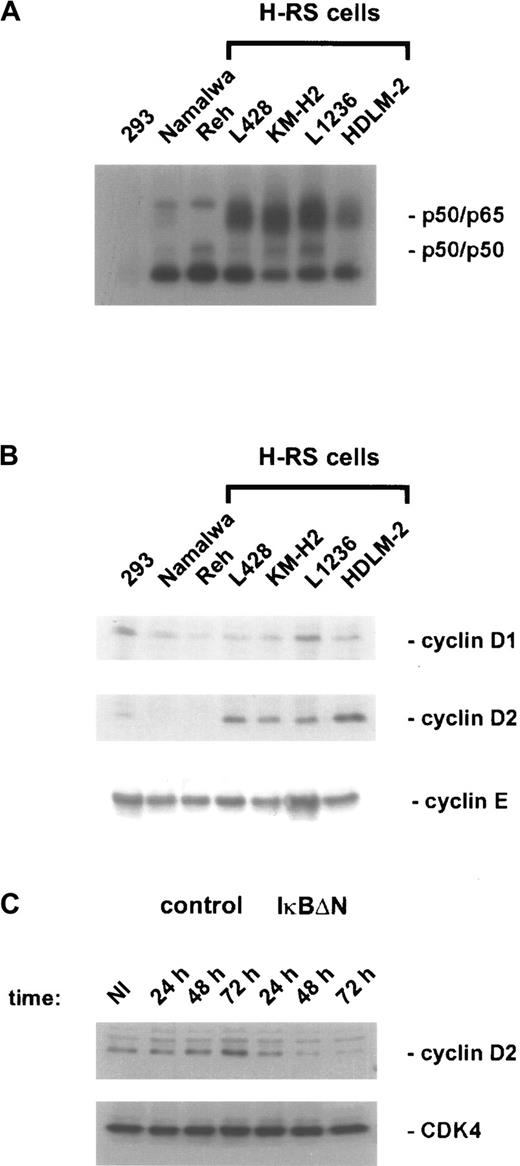 Fig. 3. Cyclin D2 expression is NF-κB dependent. / (A) NF-κB binding activity. Whole-cell extracts of H/RS cells and control cells were analyzed by EMSA using an H2K binding site probe for NF-κB. (B) Expression of cyclins in H/RS and control cells. Steady state levels of cyclin D1, cyclin D2, and cyclin E proteins were determined by Western blotting using specific antibodies, as indicated (see “Materials and methods”). (C) Cyclin D2 expression of Ad5-control– and Ad5-IκBΔN–infected L428 cells. Whole-cell extracts of noninfected and infected L428 cells were prepared at the indicated time points and analyzed by Western blotting with anticyclin D2 antibody (upper panel). The blot was stripped and reprobed with anti-CDK4 antibody (lower panel). NI indicates noninfected.