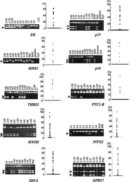 Fig. 1. Examples and summary of methylation analysis of multiple CpG islands in AML. / Aberrant methylation was detected by bisulfite-PCR (left of each panel) and quantitated by densitometry, and a scatter plot of all the data in 36 patients is shown on the right of each panel. The genes examined are shown below each panel. After bisulfite modification, DNA was amplified by means of primers that amplify methylated and unmethylated alleles equally. PCR products were then digested with the use of restriction enzymes that cleave methylated alleles only. Methylation bands are indicated by arrows.