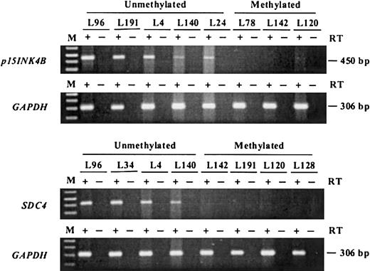 Fig. 4. Expression analysis of p15 andSDC4 by RT-PCR. / Complementary DNA was amplified by means of gene-specific primers and electrophoresed in 1.5% agarose gels; p15 mRNA was detectable in all the unmethylated samples but none of the methylated samples. Similar results were obtained for SDC4. The methylation status of each sample is shown above each lane. The integrity of RNA was verified by RT-PCR by means of primers specific for GAPDH. M is the marker lane. + indicates lanes where reverse transcriptase was added while − indicates lanes where reverse transcriptase was omitted (negative controls).