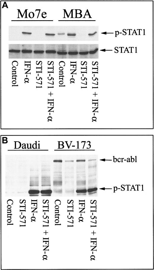 Fig. 3. STI-571 does not inhibit other Jak/Stat signaling cascades. / (A) Mo7e or MBA cells were pretreated with nothing or STI-571 (5 μM) for 30 minutes and subsequently treated with IFN-α (500 U/mL; 30 minutes) before cell lysates were collected and analyzed for Stat-1 activation by immunoblotting with phospho–Stat-1–specific antibody. The blot was stripped and reprobed with anti–Stat-1 as a control. (B) Daudi (left) or BV-173 (right) cells were treated with 5 μM STI-571 alone or subsequently treated with IFN-α, as described above, before cell lysates were analyzed for Stat-1 activation with anti–p-Stat-1. Anti–p-Stat-1 also recognizes activated bcr-abl (as described in Figure 2) and can be used as a control to demonstrate that STI-571 reduces bcr-abl activation without affecting IFN-α–mediated Stat-1 phosphorylation in BV-173 cells.
