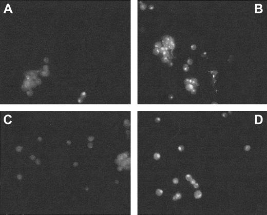 Fig. 2. Immunofluorescence assessment of H-FT levels in K562 cells. / Cells were incubated for 48 hours with 1 nM ASH-ODN (A), nothing (untreated cells, B), preimmune rabbit serum (C), and 1 nM IN-ODN sequence (D). Immunofluorescence was assayed by incubating the cells with mouse monoclonal antibodies against human H-FT. FITC-conjugated antirabbit IgG served as a secondary antibody.