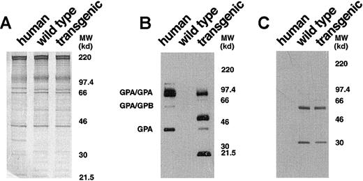 Fig. 3. Western blot analysis of human and murine GPA expression. / (A) Equivalent loads (4 μg/lane) of human, wild-type mouse, andGYPA transgenic mouse red cell proteins were subjected to electrophoresis in a 10% SDS-PAGE gel and stained with Coomassie brilliant blue. No differences were noted in the major red cell membrane proteins in the transgenic sample when compared with the normal mouse sample. (B) Human, wild-type mouse, and GYPAtransgenic mouse red cell proteins (4 μg/lane), separated on an 8% SDS-PAGE gel, were immunoblotted using monoclonal antibody BRIC 163 against the cytoplasmic domain of human GPA. (C) Human, wild-type mouse, and GYPA transgenic mouse red cell proteins were immunoblotted using monoclonal antibody TER-119 against mouse GPA. MW indicates molecular weight.