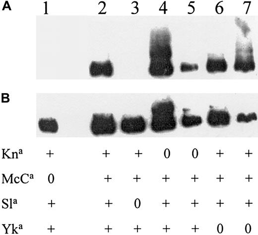 Fig. 2. Localizing KN antigens to LHR-D. / Western blots of red cell CR1 from donors selected for their KN phenotype (shown below each lane). (A) The MAb 3C6.D11 raised against LHR-D. To demonstrate that protein was present in lanes 1 and 3, the same blot was washed and incubated with another CR1 MAb (J3D3) that is known to react with all size and blood group variants of CR1 (B).