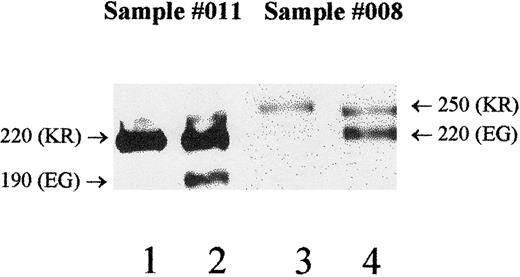 Fig. 4. McC/Sla haplotypes were determined by Western blot to resolve typing discrepancies. / Donor no. 011 (Table 8) exhibits weaker expression of the 190-kd form and normal expression of the 220-kd protein (lane 2) when probed with the standard anti-CR1 (J3D3). Probing with the monoclonal anti-McCa (6B1.H12) shows that only the 220-kd protein carries McCa (lane 1). Therefore, the 190-kd form carries McCb, and because of its weak expression, a false-negative result is obtained for serologic typing. Donor no. 008 (Table 8) has a low total RBC-CR1 level (186 copies/RBC) and exhibits weaker expression of the 250-kd form compared with the 220-kd form (lane 4). With the use of MAb 3C6.D11, the 250-kd protein is shown to carry both McCa and Sla (lane 3). The low expression of this allele contributes to the false-negative serologic typing for both McCa and Sla. Molecular weights are noted to the side of each allele, and the genotypes for positions 1590 (McC) and 1601 (Sla) are in parentheses.