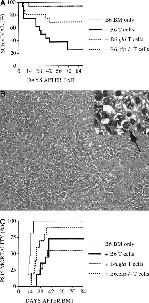 Fig. 7. B6D2F1/J recipients of perforin-deficient B6.pfp−/− donor T cells display less GVL activity against P815 mastocytoma. / (A) On day 0, all B6D2F1 recipients received lethal irradiation (1300 cGy) and then B6 TCD-BM cells (5 × 106). In addition, some recipients received splenic T cells (2 × 106) from normal B6, B6.gld, or B6.pfp−/− donors. Death from GVHD is shown as a Kaplan-Meier survival curve. Recipients of B6.pfp−/− T cells had significantly fewer deaths than recipients of B6 T cells (P < .04) and more deaths than recipients of B6.gld T cells (P < .04). Combined data from 2 experiments with 16 animals per group are shown. (B, C) B6D2F1/J mice received transplants as in panel A, but all recipients received 1000 P815 mastocytoma cells in addition on day 0 after the lethal irradiation. Recipients of B6 TCD-BM succumbed to P815 mastocytoma, and hepatomegaly and liver metastases were observed at autopsy. Liver tissue was preserved in formalin (10%) and embedded in paraffin, and tissue sections were stained with hematoxylin and eosin. Histopathologic examination revealed extensive tumor infiltration with a loss of liver architecture (large picture; original magnification, 100 ×), many large round to polyhedral cells with small basophilic cytoplasmic granules, and empty vesiculated nuclei with large nucleoli and frequent mitotic figures (arrow, inset: original magnification, 1000 ×). Mortality of GVHD survivors from P815 mastocytoma is shown in panel C. Results from 3 combined experiments with 10 to 17 animals per group are shown. Recipients of B6.pfp−/− T cells had significantly more deaths than recipients of B6 T cells (P < .03) or B6.gld T cells (P = .02).