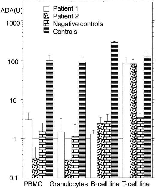 Fig. 1. ADA enzyme activity in various cells from the patients. / The columns indicate the geometric mean of ADA activity (U; nmol/min/108 cells) and the positive error bars indicate the SDs. Negative controls except for T-cell line are obtained from another ADA-deficient patient before the gene therapy.5TJF2 cell line15 was used as negative control for T-cell line. Note that only T-cell lines from the patients show elevated enzyme activity.