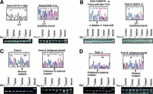Fig. 2. Mutation analysis. / Mutation analysis of the patient 1 (A) and patient 2 (B) with ADA deficiency and the reversion in T-cell lines from patient 1 (C) and patient 2 (D). Arrows indicate mutation sites. Each mutation was confirmed by digestion of the PCR fragment with a restriction enzyme indicated at the left end of each lower column. Each enzyme cuts only the fragment including the mutation, and both patterns with (+) and without (−) the enzyme are shown. Paternally inherited mutation of patient 1 and maternally inherited mutation of patient 2 were reversed. Digestion studies verified the reversions. An asterisk indicates the sample obtained from the T-cell line. Molecular marker used is φX 174HaeIII digested.