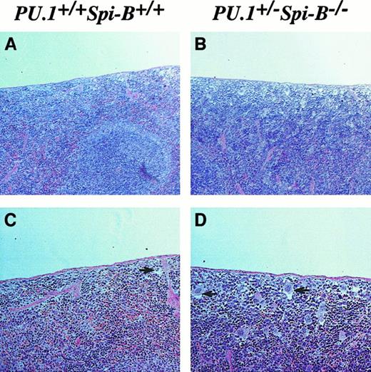 Fig. 2. Extramedullary hematopoiesis in the spleen. / Spleens were harvested from wild-type and PU.1+/−Spi-B−/− mice, fixed in formalin, sectioned, and stained with hematoxylin and eosin. The presence of megakaryocytes under the capsule of the spleen is indicated by the black arrows. Occasional megakaryocytes are found in wild-type spleens, but the numbers are increased greatly in PU.1+/−Spi-B−/− spleens. (Original magnifications: panels A and B, × 20; panels C and D, × 40.)