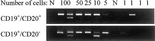 Fig. 1-1. ASO IgH RT-PCRs were performed on a serial dilution of CD19+/CD20+ and CD19+/CD20− cells (performed by a cell sorter). / The result shown illustrates that therapies using anti-CD20 antibodies only target a subset of the clonotypic B lymphocytes.