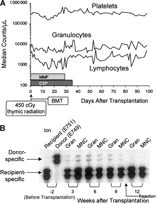 Fig. 1. Effects of thymic radiation and postgrafting MMF/CSP. / (A) Platelet, granulocyte, and lymphocyte changes in 5 dogs given 450 cGy thymus irradiation, DLA-identical littermate marrow grafts, and MMF/CSP after transplantation. (B) Results of microsatellite marker studies of donor and recipient (dog E751) cells before transplantation (lanes 1 and 2) and recipient cells after marrow transplantation (lanes 3-10). Gran indicates granulocytes; MNC, mononuclear cells.