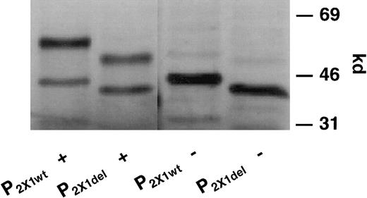 Fig. 2. SDS-PAGE analysis of 35S-methionine–labeled P2X1wt and P2X1del receptors after transcription and translation reactions. / Proteins translated from P2X1wt and P2X1delplasmid (pcDNA3.1) DNAs were radiolabeled with35S-methionine using a coupled transcription–translation (TnT) rabbit reticulocyte system in the presence or absence of microsomes. Note the differences in the apparent molecular sizes for translated proteins between different plasmid constructs, separated by SDS-PAGE, in the presence of microsomes (lanes 1 and 2) or in their absence (lanes 3 and 4). Note that each plasmid preparation contains only P2X1wt or P2X1del DNA and that, therefore, only homomeric receptor complexes can be formed.