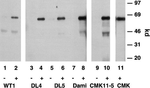 Fig. 3. Immunoreactive characterization of the P2X1receptor. / Immunoprecipitation of surface-expressed P2X1wt and P2X1del receptors stably transfected into 1321 astrocytoma cells or on native megakaryoblastic or megakaryocytic cells. Surface-biotinylated 1321 cells transfected with P2X1wt(lanes 1 and 2) or 2 individual P2X1del receptors (DL 4 and DL 5, lanes 3-6), Dami cells (lanes 7 and 8), CMK 11-5 cells (lanes 9 and 10), or CMK cells (lane 11) were solubilized in RIPA buffer and antigens immunoprecipitated with the anti-hP2X1 pAb (+) but not with the preimmune antibody (−). Note that the apparent size of the single 67-kd protein is identical in direct comparisons between the P2X1wt and P2X1del clones and native Dami, CMK 11-5, and CMK cells.