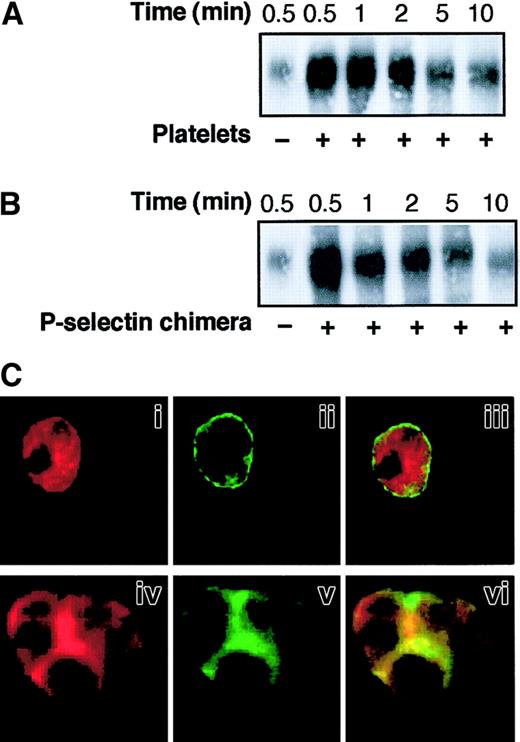 Fig. 4. P-selectin triggers CD18 redistribution to Triton X-100–insoluble cytoskeletal fraction and colocalization of Mac-1 clusters with F-actin patches at the site of cell-cell contact. / PMNLs were incubated with platelets (A) or 10 μg/mL P-selectin–IgG chimera (B) for different times in standard conditions. Samples were lysed with CSK buffer, and proteins associated with the Triton X-100–insoluble cytoskeletal fraction were subjected to 6% SDS-PAGE and transferred to Immobilon membrane. The presence of CD18 was analyzed by Western blotting using the anti-CD18 antibody KIM127. The figure shows the results representative of 5 different experiments. (C) PMNLs were incubated for 2 minutes in standard conditions in the absence (i-iii) or in the presence of P-selectin–IgG chimera (iv-vi). After incubation, CD11b and F-actin were stained using the anti-CD11b antibody OKM10, followed by goat anti–mouse Alexa Fluor 488 antibody and rhodamine-phalloidin, respectively, and processed for confocal laser scanning microscopy. Images represent confocal micrographs from the middle third of a single unstimulated cell (i-iii) and of an aggregate of 3 cells (iv-vi). Panels i and iv show F-actin staining, and ii and v show CD11b staining. In the overlay (iii, vi), yellow represents colocalization of the 2 stainings. The figure reports the results of a representative of 5 different experiments.