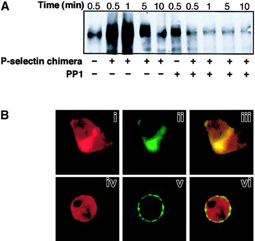 Fig. 5. SRC tyrosine kinase activity is required for P-selectin–triggered CD18 redistribution to Triton X-100–insoluble cytoskeletal fraction and colocalization of Mac-1 clusters with F-actin patches at the site of cell-cell contact. / PMNLs were preincubated for 1 minute at 37°C with DMSO or 25 μM PP1 before the addition of 10 μg/mL P-selectin–IgG chimera. (A) Coincubation in standard conditions was stopped at different times. Samples were processed, and the presence of CD18 in Triton X-100–insoluble cytoskeletal fraction was analyzed as in Figure 4. (B) PMNLs, pretreated with DMSO (i-iii) or with 25 μM PP1 (iv-vi), were stimulated by 10 μg/mL P-selectin–IgG chimera for 2 minutes. After stimulation, CD11b and F-actin were stained and processed for confocal laser scanning microscopy as in Figure 4. Panels i, ii, and iii show an aggregate of 2 cells. Panels i and iv show F-actin staining, ii and v show CD11b staining. In the overlay (iii, vi), yellow represents colocalization of the 2 stainings. The figure is representative of results obtained in 5 different experiments.