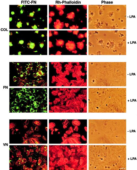 Fig. 1. Fluorescence microscopy of washed platelets adherent on collagen (COL)-, FN-, or VN-coated coverslips. / Platelets were placed on the coverslips for 15 minutes and then incubated with 20 mg/L FITC-FN, 2 mM Ca++ in HEPES-Tyrode buffer supplemented with 1 g/L FA-free albumin in the absence (−) or presence (+) of LPA, 1 μM. Platelets were washed and fixed in 3% paraformaldehyde in PBS, pH 7.3, for 30 minutes; permeabilized with 0.4% octylglucopyranoside in PHEM buffer for 2 minutes; incubated with 0.1 mg/L rhodamine-labeled phalloidin; and photographed for FITC-FN, rhodamine, and phase contrast. Comparison of the fluorescence associated with platelets on the 3 substrates shows the heaviest deposition of FITC-FN by platelet aggregates adherent on collagen without or with additional agonist. Deposition of FITC-FN by spread platelets adherent to FN or VN was enhanced by LPA. Bar = 10 μm.