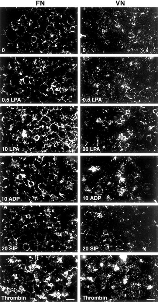 Fig. 3. Fluorescence microscopy of FITC-FN assembly in response to different agonists on FN- or VN-coated coverslips. / After a 15-minute adherence phase, coverslips were incubated for 1 hour with 20 mg/L FITC-FN in the presence of no agonist (0); 0.5, 10, or 20 μM LPA; 10 μM ADP; 20 μM S1P; or 1 U/mL thrombin. Phase contrast microscopy (not shown) revealed monolayers of platelets under all conditions. Bar = 10 μm.