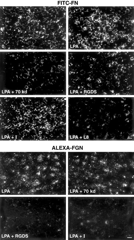 Fig. 4. Effects of inhibitors on FITC-FN deposition and Alexa-FGN binding. / Shown are fluorescence micrographs of washed platelets adherent on FN-coated coverslips for 15 minutes and then incubated with FITC-FN or Alexa-FGN. Upper panel: platelets were incubated for 1 hour with 20 mg/L FITC-FN in the presence of no agonist and no inhibitor (0), 0.5 μM LPA, 0.5 μM LPA plus 30 mg/L 70-kd FN fragment, 0.5 μM LPA plus 0.5 mM RGDS, 0.5 μM LPA plus 0.5 μM integrilin (I), or 0.5 μM LPA plus 0.2 g/L L8 mAb. Lower panel: platelets were incubated for 1 hour with 20 mg/L Alexa-FGN and 0.5 μM LPA, 0.5 μM LPA plus 30 mg/L 70-kd FN fragment, 0.5 μM LPA plus 0.5 mM RGDS, or 0.5 μM LPA plus 0.2 μM integrilin (I). Phase contrast microscopy (not shown) revealed monolayers of platelets under all conditions. Bar = 10 μm.