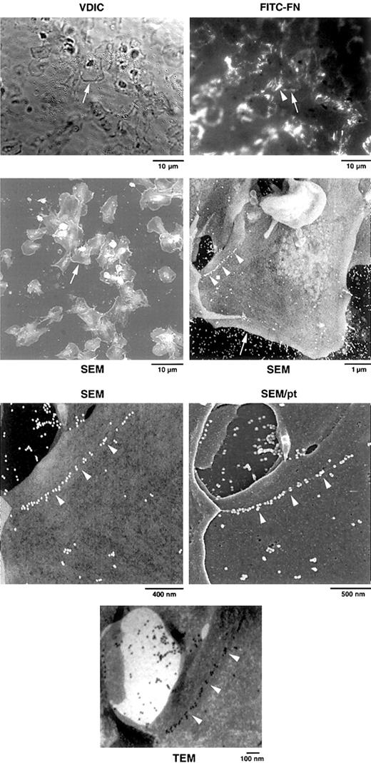 Fig. 6. Correlative light and electron microscopy of platelets adherent on an FN-coated grid. / After adherence to the grid for 15 minutes, washed platelets were rinsed and incubated for 1 hour with 1 μM LPA and 20 mg/L FITC-FN. Grids were analyzed by VDIC microscopy, fluorescence microscopy for localization of FITC-FN, and SEM and TEM for immunogold localization of FITC, as described in “Materials and methods.” SEM was done without and with coating of the sample with platinum (pt). Higher magnifications center on the platelet identified by the arrow. Note the linear arrangement of beads on the platelet surface (arrowheads) that correlates with FITC fluorescence (arrowhead). One linear array extends to a neighboring platelet. TEM demonstrates that beads decorate filaments of less than 20 nm in diameter.