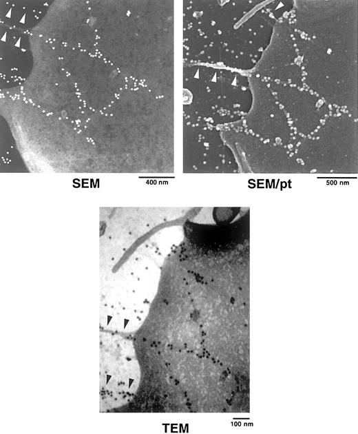Fig. 7. SEM and TEM localization of FITC-FN on a platelet adherent on an FN-coated grid. / Samples were processed as in Figure 6. SEM without platinum coating demonstrates linear arrays of beads that extend from the platelet surface to the FN-coated substratum (arrowheads). TEM of the same platelet demonstrates beads decorating filaments (arrowheads) that are less than 20 nm in diameter. SEM after platinum (pt) coating demonstrates that one of the extensions is associated with a filopodial process (arrowheads).