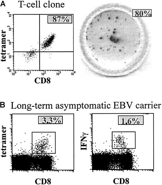 Fig. 1. Tetramer staining and IFN-γ production of a T-cell clone and PBMCs. / (A) The left panel shows tetramer staining of a T-cell clone of which most of the T cells are specific for one peptide, revealing the presence of ∼ 87% tetramer+ CD8+ T cells (upper right quadrant). In the right panel, a well of a 96-well nitrocellulose-backed plate containing spots is shown, revealing ∼100 IFN-γ–producing T cells (∼80%) after peptide stimulation of ∼125 cells of the T-cell clone, which comes down to ∼93% IFN-γ–producing tetramer+ T cells. (B) Percentage tetramer staining (3.3%, left panel) and percentage IFN-γ–producing CD8+ T cells after peptide (RAK) stimulation and intracellular IFN-γ staining (1.6%, right panel) of PBMCs of a healthy EBV carrier.