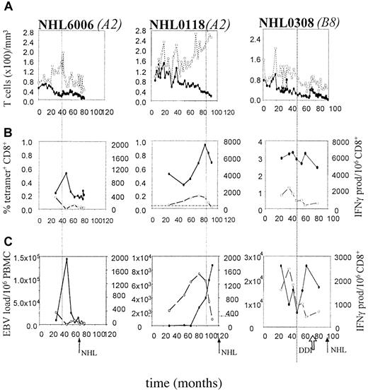 Fig. 5. Presence and function of EBV-specific CD8+ T cells and EBV load in 3 HIV-1 infected individuals with AIDS-NHL. / On the x-axis follow-up is indicated in months after HIV-1+entry in the study. The arrows indicate the time of AIDS-NHL diagnosis (NHL) and start of antiretroviral therapy (DDI). The vertical dotted line indicates the time point at which CD4+ T cell counts drop below 200/μL. (A) Longitudinal analysis of CD4+ and CD8+ T-lymphocyte numbers. (●) indicates CD4; (○), CD8. (B) Longitudinal analysis of EBV-specific CD8+ T lymphocytes as assessed by tetramer staining as a composite of all tested tetramers (solid line) and IFN-γ Elispot assay (dashed line), as described in “Patients, materials, and methods.” (●) indicates tetramer; (○), IFN-γ. (C). Longitudinal analysis of EBV load, expressed as the number of virus copies per 106 PBMCs (solid line), in comparison with the number of functional EBV-specific CD8+ T lymphocytes per 106 CD8+ T cells (dashed line). (●) indicates EBV load; (○), IFN-γ.