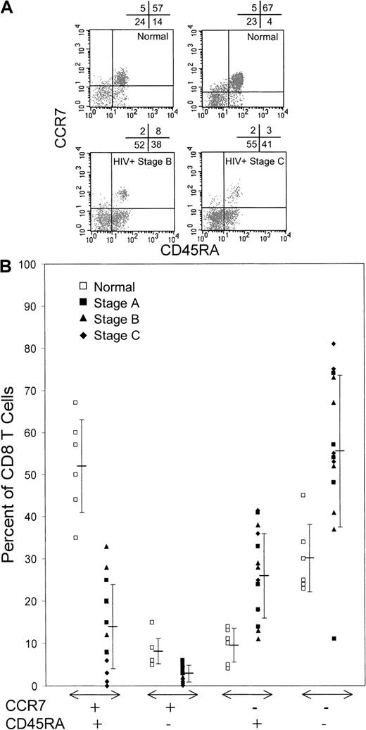 Fig. 1. HIV-infected donors have few CCR7+naı̈ve (CCR7+CD45RA+) or long-term memory (CCR7+CD45RA−) CD8 T cells but compensate with expansions of effector (CCR7−CD45RA+) and effector memory (CCR7−CD45RA−) cells. / (A) Representative dot plots of gated CD8bright lymphocytes from healthy donors and HIV-infected donors classified according to disease stages determined in 1993 by the CDC.32 (B) Summary of CCR7 and CD45RA costaining data from healthy donors and HIV-infected donors. The proportion of CCR7+ naı̈ve and long-term memory cells was lowest in patients with stage C AIDS. The differences between healthy donors and HIV-infected donors are significant.