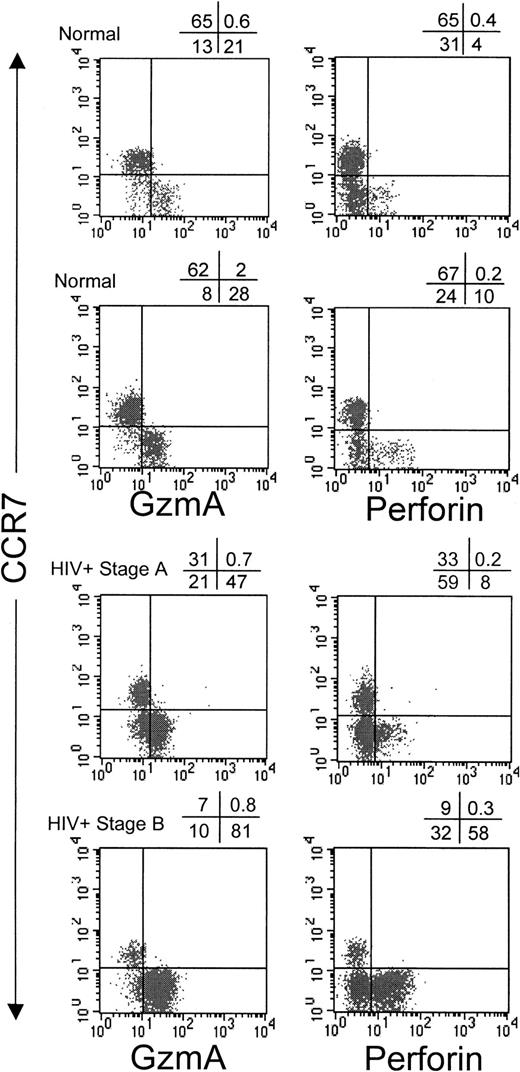 Fig. 2. Circulating CCR7+ CD8 T cells in healthy donors and HIV-infected donors do not express GzmA or perforin. / Representative dot plots show costaining of gated CD8brightlymphocytes with CCR7 and GzmA or perforin.
