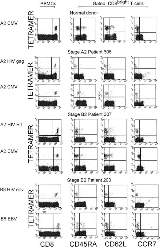 Fig. 4. Antigen-specific CD8 T cells from healthy donors and HIV-seropositive donors (various disease stages), stained with A0201 and B8 tetramers for HIV, CMV, and EBV epitopes, do not express LN-homing receptors. / Representative dot plots for costaining of the indicated tetramers with CCR7, CD62L, and CD45RA are shown. Although the pattern of CCR7 and CD62L staining for tetramer+ CD8 T cells responding to all 3 viruses was similar, CD45RA staining was reduced in HIV-specific T cells compared with cells specific for the other viruses causing chronic infections.