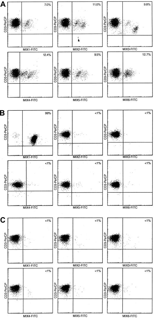 Fig. 2. Flow cytometric Vβ repertoire analysis using Vβ mAb mixtures in mature T-cell proliferation patients. / (A) In healthy controls, 60% to 65% of CD3+ cells are recognized in double immunofluorescence stainings with 6 different Vβ mAbs mixtures in combination with CD3-PerCP.10 (B) Using comparable stainings in T-CLL patient 98-086, 99% of CD3+ cells are recognized by Vβ mAbs mix 1, whereas all other 5 mixes only recognize less than 1% of all CD3+cells. This indicates the presence of a large, presumably clonal CD3+ T-cell population with single Vβ expression. (C) Double immunofluorescence stainings with the 6 Vβ mAbs mixtures resulted in less than 5% CD3+/Vβ+ cells in T-CLL patient 98-002, suggesting the presence of a large, presumably clonal CD3+ T-cell population with single Vβ expression not recognized by any of the Vβ mAbs in the current panel.