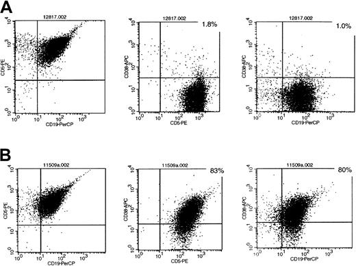 Fig. 1. Representative flow cytometry profiles of CD38 expression in patients with B-CLL. / (A) Sample of patients negative for CD38 expression (less than 20%). (B) Sample of patients positive for CD38 expression (20% or more). Directly labeled antibody for CD5-PE, CD19-PerCP, and CD38-APC.