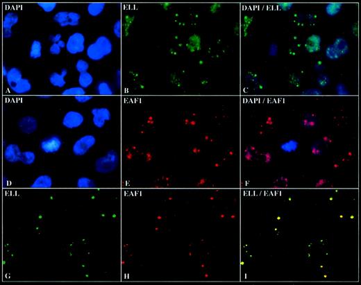 Fig. 5. ELL colocalizes with EAF1 in nuclear speckles. / (A) DAPI staining of HeLa cells. (B) Immunofluorescence with the affinity-purified polyclonal ELL antibody detected with fluorescein isothiocyanate (FITC)-labeled goat antirabbit antibodies. (C) Dual fluorescence imaging of ELL and DAPI showing that the speckles are nuclear. (D) DAPI staining of HeLa cells. (E) Immunofluorescence with the monoclonal EAF1 antibody detected with RRX-labeled goat antimouse antibodies. (F) Dual fluorescence imaging of EAF1 and DAPI. (G) Confocal microscopy with the affinity-purified polyclonal ELL antibody detected with FITC-labeled goat antirabbit antibodies. (H) Confocal microscopy with the monoclonal EAF1 antibody detected with Cy5-labeled goat antimouse antibodies. (I) Merged confocal image of ELL and EAF1 revealed colocalization.
