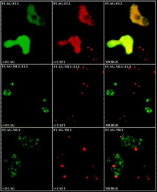 Fig. 7. Delocalization of EAF1 by transient expression of MLL-ELL. / HeLa cells were transiently transfected with FLAG-tagged ELL, MLL-ELL, and the amino-terminus of MLL. Expression of these constructs was visualized by confocal microscopy using a biotinylated anti-FLAG antibody and streptavidin-FITC, and expression of endogenous EAF1 was visualized using the EAF1 monoclonal and Cy-5 labeled goat antimouse antibodies. In the upper row, an overall increase in the number of EAF1 speckles was observed in the cells transfected with FLAG-ELL. In the middle row, EAF1 was delocalized from its typical speckled distribution by expression of FLAG-MLL-ELL. In the lower row, the EAF1 pattern was not affected by expression of the amino-terminus of MLL.