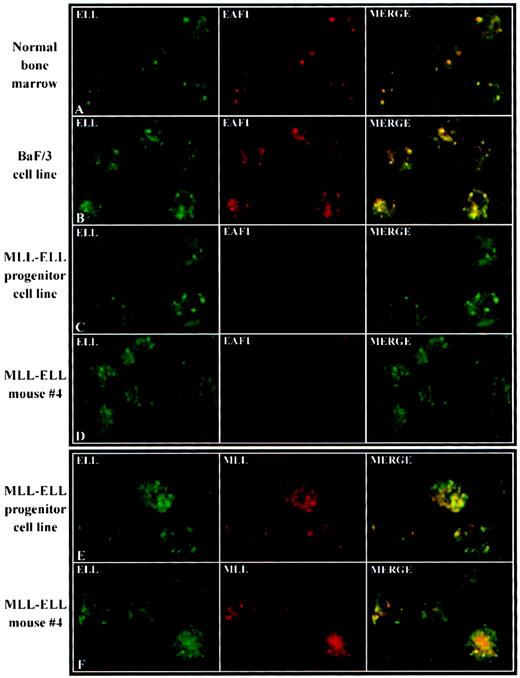 Fig. 8. Delocalization of EAF1 in murine MLL-ELL leukemic cell lines. / Murine hematopoietic cells were examined with antibodies to ELL, EAF1, or MLL as indicated in the upper left of each image. To confirm the normal expression patterns of ELL and EAF1 in murine hematopoietic cells, confocal microscopy was used to examine normal bone marrow progenitor cells (A) and the BaF/3 cell line (B). ELL and EAF1 colocalized in a nuclear speckled pattern similar to that observed in human cells. To determine the distribution of EAF1 in cells that stably expressed the MLL-ELL fusion protein, we examined a cell line derived from hematopoietic progenitors that were immortalized in vitro by MLL-ELL (C) and a cell line derived from MLL-ELL leukemic mice (D). Confocal microscopy in both of these cell lines showed expression of ELL in a punctate pattern. In contrast, EAF1 exhibited a fainter, diffuse nucleoplasmic pattern, with no speckles detected. These cell lines were also incubated with antibodies to MLL and ELL, which revealed a punctate pattern for both proteins (E,F). A subset of the MLL and ELL speckles colocalized, suggesting that both antibodies were detecting the MLL-ELL fusion protein.