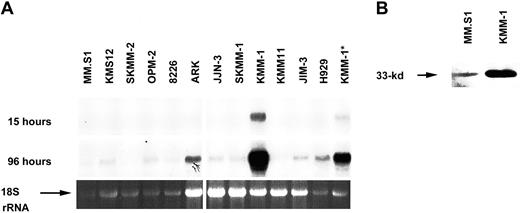 Fig. 1. Expression of cyclin D3 in MM cell lines. / (A) Northern blot containing 30 μg (10 μg for sample marked by asterisk) total RNA from each MM cell line was hybridized with a cyclin D3 probe. A portion of the film encompassing the 2.4-kb cyclin D3 mRNA is shown for 15- and 96-hour exposures. Ethidium bromide–stained 2.0-kb ribosomal RNA (rRNA) is shown as a loading control. (B) Western blot containing 100 μg total protein for each of 2 MM cell lines was probed with an anti–cyclin D3 antibody (no. SC-182). A portion of the film containing the 33-kd cyclin D3 band is shown.
