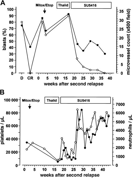 Fig. 1. Leukemic blast cell infiltration, bone marrow microvessel density and peripheral blood cell counts. / (A) Leukemic blast cell infiltration determined by cytologic analyses (○) and bone marrow microvessel density (●) during the course of the disease and different antileukemic treatments. Duration of the treatment with mitoxantrone/etoposide (Mitox/Etop), thalidomide (Thalid), and SU5416 is indicated at the top of the figure. D represents values obtained at initial diagnosis; CR, values obtained at the time of complete remission. (B) Platelet (○) and neutrophil counts (●) during different treatments of the patient's second AML relapse.