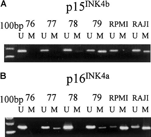 Fig. 1. Methylation-specific PCR of thep15INK4b and p16INK4agenes in selected plasma cells from patients with MGUS. / MS-PCR was performed with specific primers for unmethylated (U) and methylated (M) p15INK4b and p16INK4a alleles in Raji and RPMI-8226 cell lines as control and in CD138-selected MGUS plasma cells (samples 76, 77, 78, and 79). PCR product of appropriate molecular weight indicates the presence of unmethylated and/or methylated (A) p15INK4b (162 bp and 154 bp for U and M, respectively) and (B) p16INK4a alleles (154 bp and 145 bp for U and M, respectively) in that sample.
