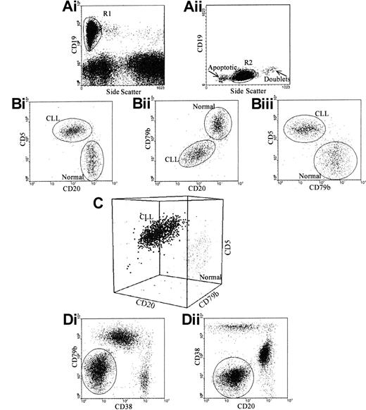 Fig. 2. Gating strategy for specific identification of CLL cells. / (A) Total B cells were identified using 2 regions: (i) CD19 and side scatter, to exclude granular cells showing nonspecific CD19 binding; and (ii) forward and side scatter, to exclude apoptotic cells and doublets. (B) CLL cells were separated from normal B cells according to their CD5, CD20, and CD79b. CLL cells could be separated from normal B cells using (i) CD5 versus CD20 in 82% of cases; (ii) CD79b versus CD20 in 35% of cases; and (iii) CD5 versus CD79b in 88% of cases. (C) To separate CLL cells from normal B cells, all 3 antigens must be assessed on gated B cells. (D) To separate CLL cells from normal B cells and normal B progenitors in the bone marrow in all cases, CD38 is included; this requires 2 tests: (i) CD19 versus CD5 versus CD38 versus CD20; and (ii) CD19 versus CD5 versus CD38 versus CD79b.