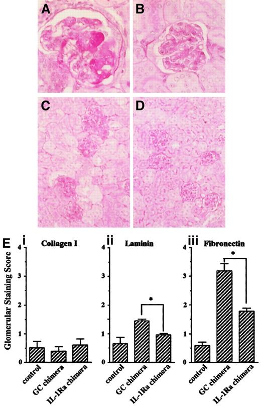 Fig. 5. Histology of kidney after nephritis induction in IL-1Ra and GC chimera (day 28). / Kidney sections from nephritis-induced chimeric mice were subjected to PAS staining. (A,C) GC chimera; (B,D) IL-1Ra chimera (original magnification: × 400 for panels A and B, × 100 for panels C and D). (E) To semiquantify the severity of glomerular damage, relative amounts of glomerular staining of type I collagen (i), laminin (ii), and fibrinogen (iii) were scored as described in “Materials and methods.” Data are shown as means ± SE. Asterisks indicate significant differences (P < .05) between the 2 groups.
