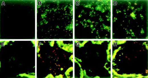 Fig. 6. Identification of transplanted donor cells in chimeric mice using FISH. / To trace the transplanted donor cells, spleen and kidney sections from chimeric mice with or without nephritis were subjected to FISH using a Y painting probe (4 per group). Representative photographs are shown. (A) Spleen of control female mouse; (B) spleen of control male mouse; (C) spleen of untreated chimeric mouse; (D) spleen of chimeric mouse treated with anti-GBM serum (day 3); (E) kidney of control female mouse; (F) kidney of control male mouse; (G) kidney of untreated chimeric mouse; and (H) kidney of chimeric mouse treated with anti-GBM serum (day 3). Red dots show Y antigen–positive donor cells.