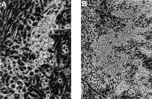 Fig. 1. Generation of hematopoietic cells from 8.5 P-Sp cells cocultured with AGM-S3 cells. / Small round cells were first detected on day 2 or 3 of culture (A, original magnification, × 200) and gradually increased by day 7 (B, original magnification, × 100).