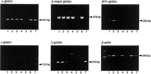 Fig. 2. Expression of embryonic and adult hemoglobin by erythroid bursts and erythrocyte-containing mixed colonies derived from 8.5 dpc YS cells and their progenies cocultured with AGM-S3 cells for 4 days. / Lane 1: an erythroid burst derived from 8.5 dpc YS cells. Lane 2: a hematopoietic mixed colony derived from 8.5 dpc YS cells. Lane 3: an erythroid burst derived from the cells cultured from 8.5 dpc YS cells on AGM-3 cells for 4 days. Lane 4: a hematopoietic mixed colony derived from the cells cultured from 8.5 dpc YS cells on AGM-3 cells for 4 days. Lane 5: a granulocyte/macrophage colony derived from 8.5 dpc YS cells. Lane 6: adult BM cells. Lane 7: 8.0 dpc YS cells.