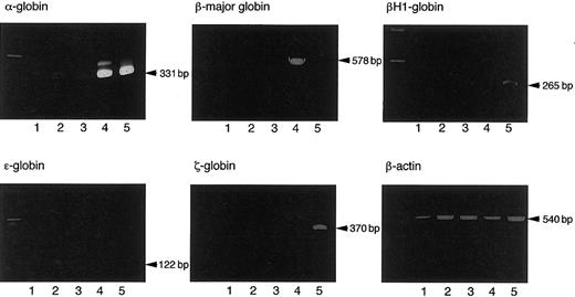 Fig. 5. Expression of embryonic and adult hemoglobins by an erythroid burst and an erythrocyte-containing mixed colony from the Ly-5.2+ cells sorted from BM cells of Ly-5.1 mouse recipients successfully engrafted with the cells cultured from 8.5 dpc Ly-5.2 mouse YS cells on AGM-S3 cells for 6 days. / Lane 1: an erythroid burst. Lane 2: a hematopoietic mixed colony. Lane 3: a granulocyte/macrophage colony. Lane 4: adult BM cells. Lane 5: 8.0 dpc YS cells.