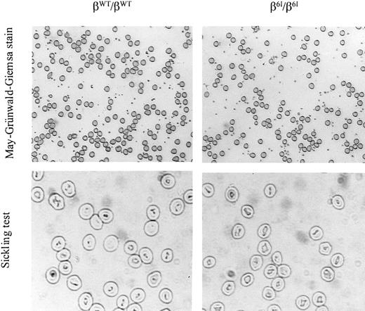 Fig. 6. Homozygous β6I mice have normal peripheral red blood cell morphology and normal hematologic parameters. / An oxygenated blood smear was prepared from a βWT/βWT mouse or a β6I/β6I mouse followed by May-Grünwald-Giemsa staining, magnification × 100. A sickling test was performed on the same fresh blood samples by viewing cell morphology under deoxygenating conditions after incubation in a 1% solution of sodium metabisulfite under coverslips, magnification × 200. A representative photomicrograph of each sample is shown.