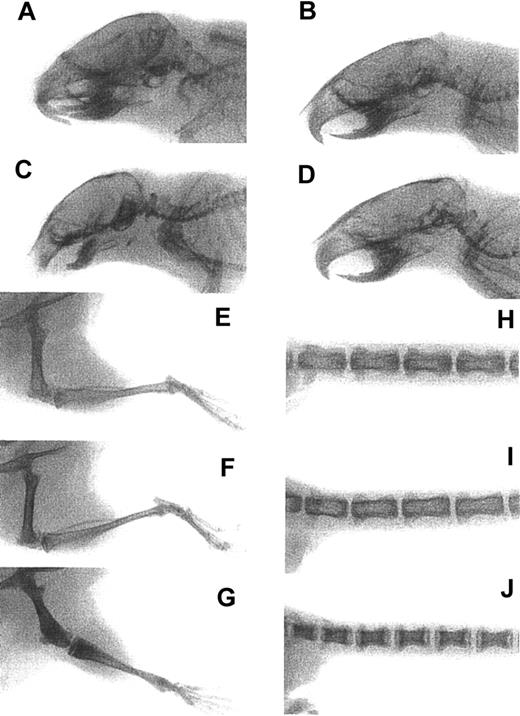 Fig. 3. Normal skeletal development in. / Csf1op/Csf1op; TgC/+mice. X-rays of 6-week-oldCsf1op/Csf1op mice injected with 12 μg recombinant human CSF-1 daily from day 3 of life (A) and 6-week-old littermate mice of genotypes +/Csf1op(B,E,H), Csf1op/Csf1op(C,G,J), and Csf1op/Csf1op; TgC/+(D, F, I).