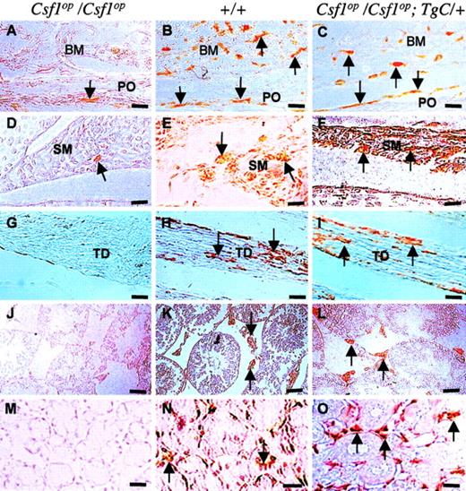 Fig. 6. Restoration of CSF-1–dependent F4/80+ macrophage populations in. / Csf1op/Csf1opmice expressing TgC. Tissues were subjected to immunostaining with the macrophage-specific monoclonal antibody F4/80. Sagittal sections of 3-month-old knee joints, showing bone marrow (BM) and periosteum (PO) (A-C) and synovial membrane (SM) (D-F). Longitudinal section of 2-week-old tibia, showing tendon (TD) (G-I), transverse sections of 2-week-old testes (J-L), and transverse sections of 3-month-old mouse sublingual salivary gland (M-O; panel M counterstained). Arrows point to regions of F4/80+staining. Bar: 50 μm.