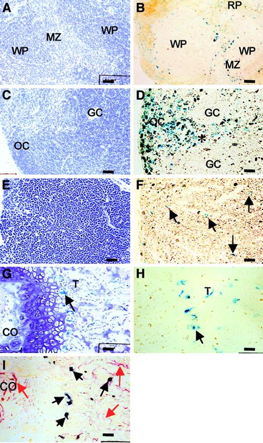 Fig. 8. CSF-1 promoter/first intron–driven β-galactosidase (TgZ) expression in hematopoietic tissues. / Stained with H&E (A, C, E, G), X-gal (A-I; some positive cells indicated by black arrows), and TRAP (I; some TRAP-positive cells indicated by red arrows). (A, B) Spleen, indicating staining of cells in the marginal zone (MZ), less intensely in the red pulp (RP), and their exclusion from the white pulp (WP). (C, D) Lymph node, showing staining of the outer cortex (OC) and the region (*) between 2 germinal centers (GC). (E, F) Thymus, revealing the presence of scattered cells in the cortex. (G-I) Bone marrow, showing β-galactosidase–expressing cells and TRAP-positive cells lining the surfaces of the bony trabeculae (T) in regions in which bone marrow fibroblasts, osteoblasts, and osteoclasts reside. TRAP-positive cells are also shown in the primary center of ossification (CO). Nuclear staining of β-galactosidase is often accompanied by some cytoplasmic staining, due to incomplete transfer of the enzyme to the nucleus. Bars: 50 mm.