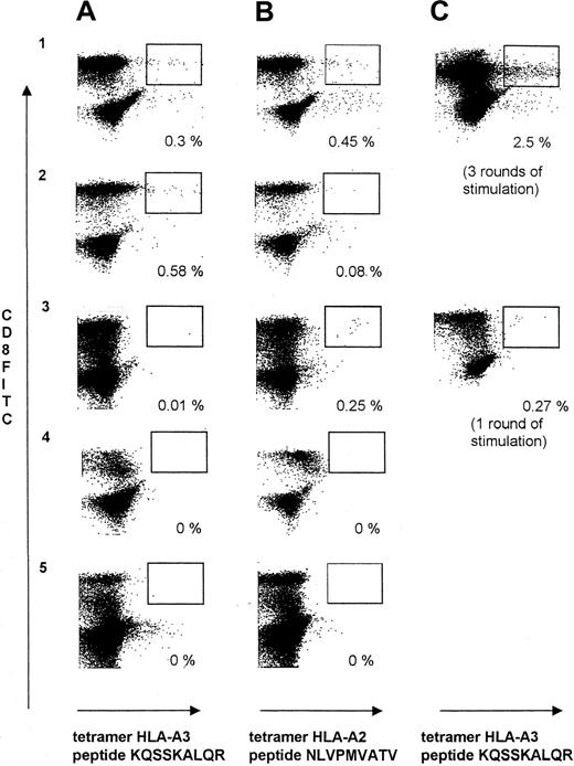 Fig. 2. Tetramer staining of patients and peptide-expanded T-cell lines. / Rows 1 to 5 refer to patients 1 to 3, 6, and 9, respectively, in the Tables; for details see Results section. (A) Left-hand panels (1-5A) display the levels of tetramer-positive cells specific for HLA-A3 and peptide KQSSKALQR from the peripheral blood. (B) Central panels (1-5B) show the levels of tetramer-positive cells specific for HLA-A2 and the CMV peptide NLVPMVATV. (C) Right-hand panels 1C and 3C show the levels of tetramer-positive cells specific for HLA-A3 and the peptide KQSSKALQR from in vitro culture following peptide stimulation and expansion.