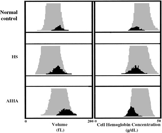 Fig. 4. Red cell and reticulocyte indices. / Volume and cell hemoglobin concentration distribution histograms of reticulocytes (dark) and red cells (gray) of a representative normal control, a representative HS, and a representative AIHA blood sample.