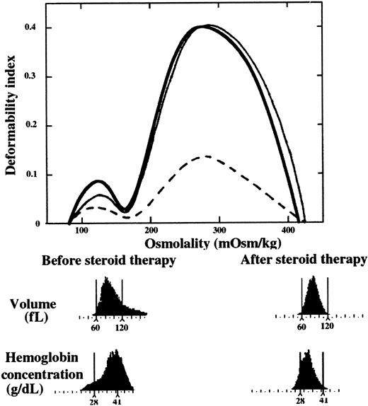 Fig. 6. Reversal of red cell abnormalities in AIHA following steroid therapy. / The osmotic deformability profiles (top panel) of blood samples from an individual with AIHA at the time of diagnosis (dashed lines) and following steroid therapy (solid line). The deformability profile of a representative normal blood sample is indicated by the thick line. Note the complete normalization of the deformability profile following treatment. Volume and cell hemoglobin concentration distribution histograms of red cells from the same individual with AIHA before and after steroid therapy. Note the complete disappearance of dehydrated red cells with cell hemoglobin concentration of more than 41 g/dL following steroid therapy.